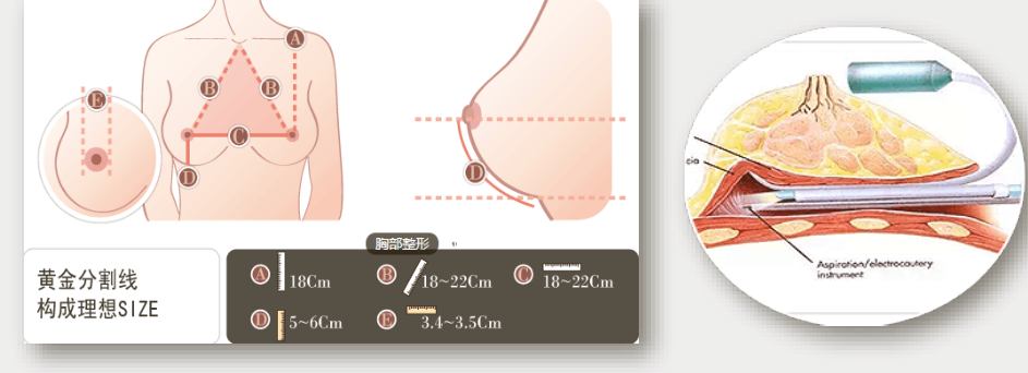 搜索引擎营销（百度）-医美整形行业