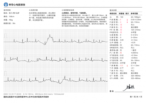 华为WATCH GT2 Pro时尚款评测：再创颜值巅峰 你的健康生活它来守护