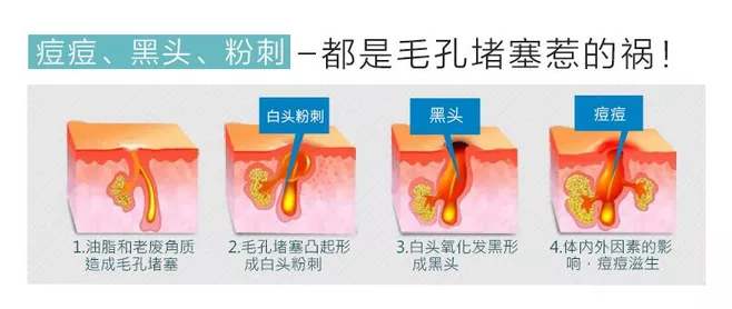 推荐洗脸皂（李佳琦推荐的芝士洁面皂报价）