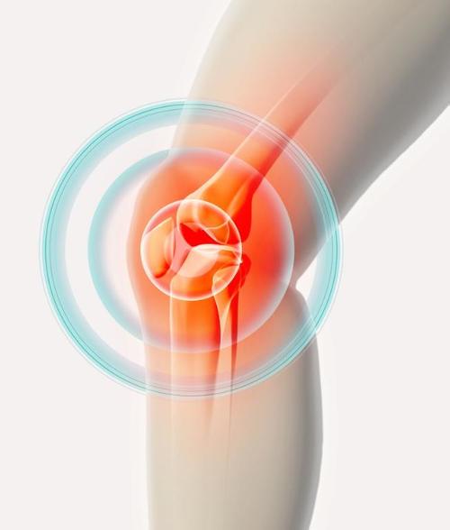 护膝的作用（全面分析护膝的作用及报价）