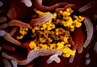 研究揭示传染性新冠病毒在一名无症状患者体内至少持续存在70天