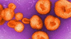 研究称在玻利维亚发现的类似埃博拉的病毒可在人与人之间传播