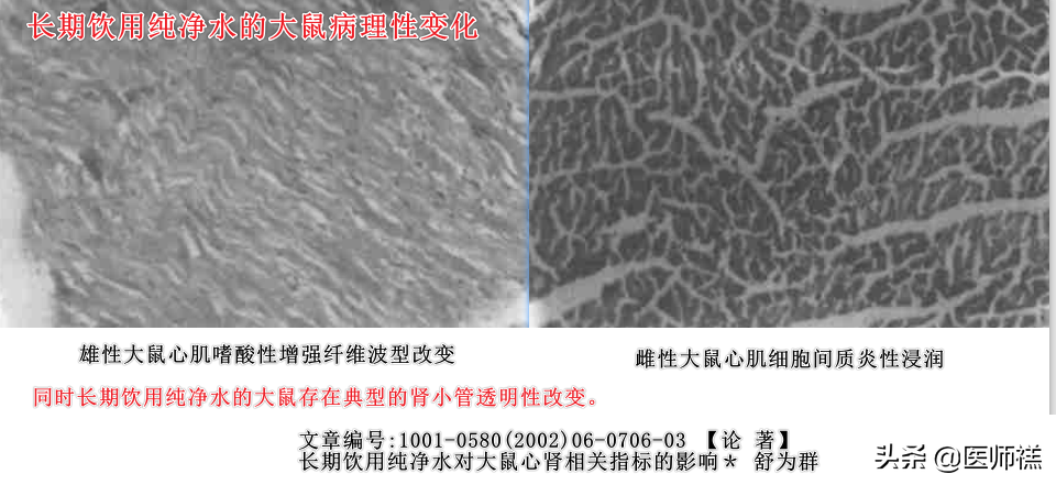 长期饮用纯净水对健康有负面影响？请看此文，带您全面了解纯净水