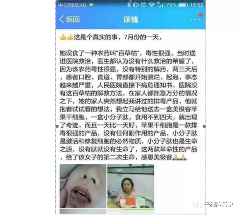 苹果干细胞是什么（一文全解）