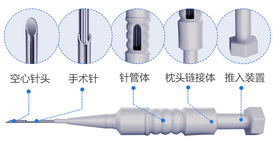 植发是什么原理（一文详解）