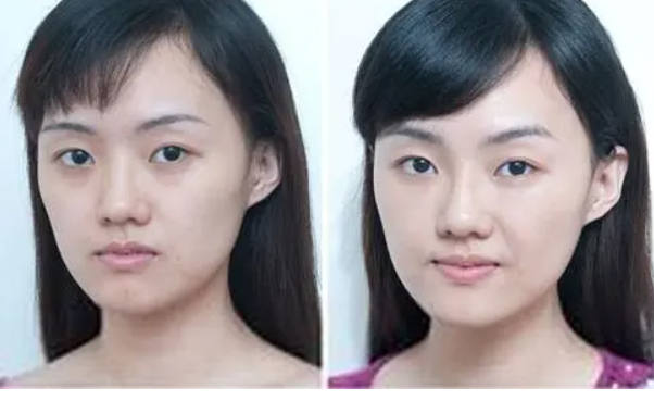 脸部凹陷怎么化妆_脸部凹陷的化妆技巧