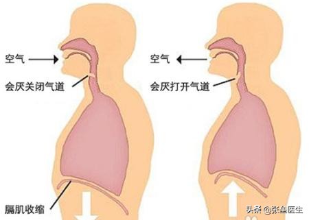 频繁打嗝怎么办_频繁打嗝的解决方法