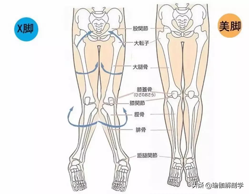 罗圈腿怎么办_罗圈腿的矫正方法