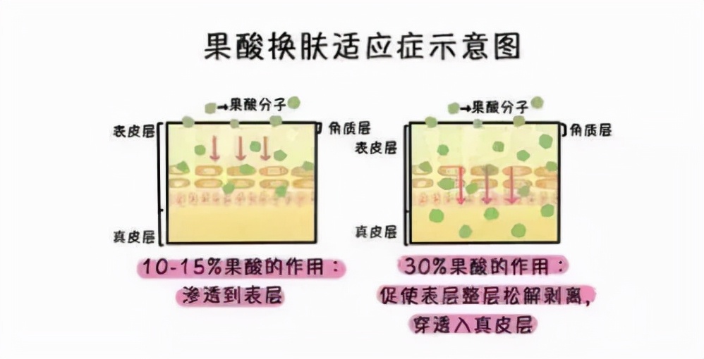 怎样修复痘坑_修复痘坑的小技巧