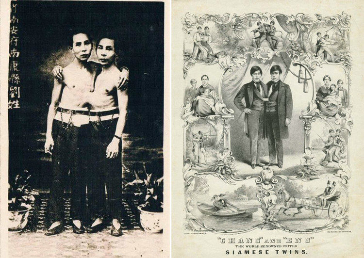 连体人如何结婚生子_看完你就懂了