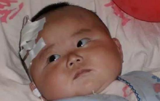 大头娃娃后面怎样了_大头娃娃事件的现状