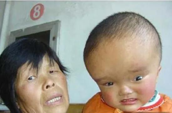 大头娃娃后面怎样了_大头娃娃事件的现状