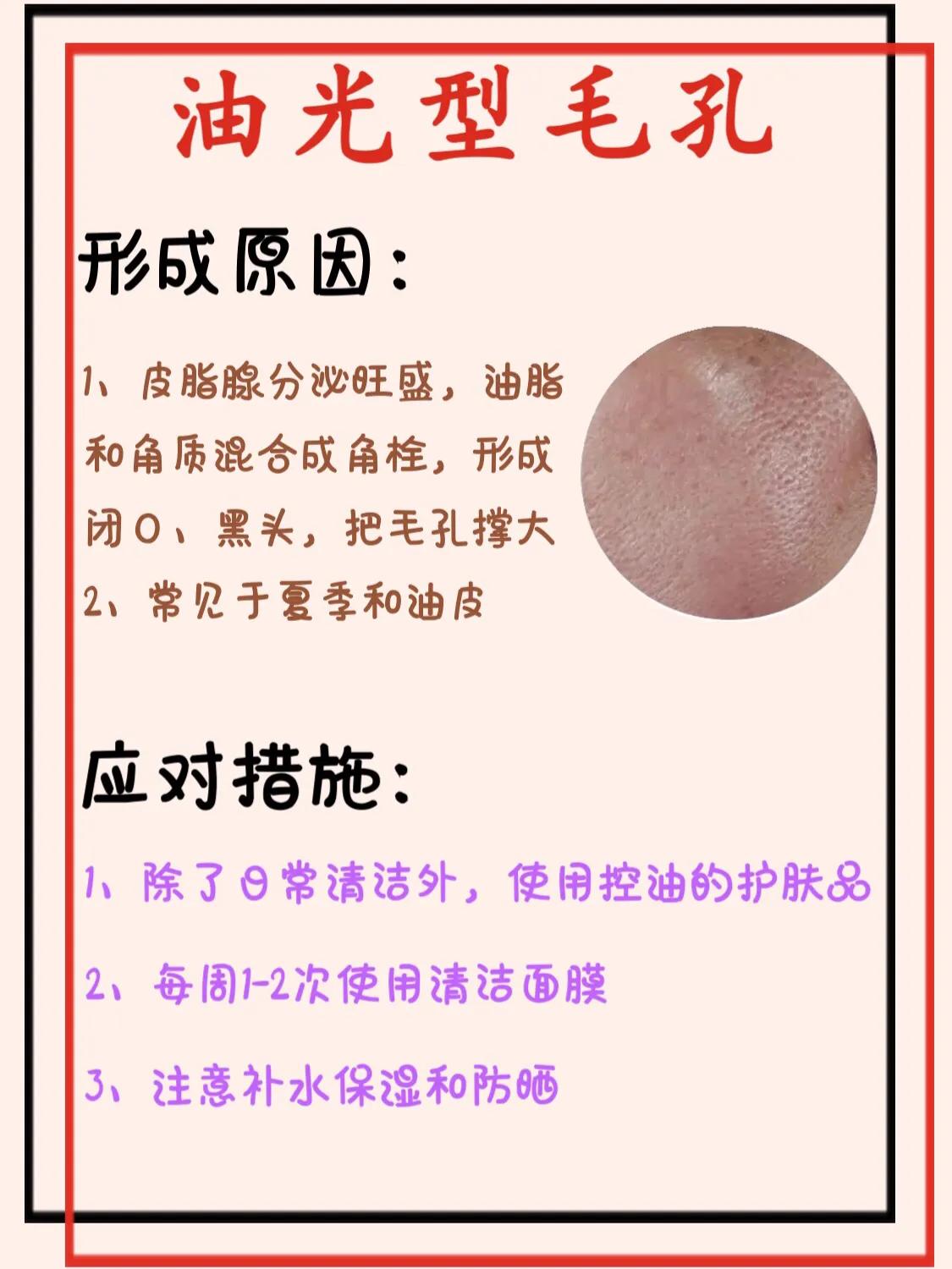 毛孔粗怎么办_教你低成本收缩毛孔