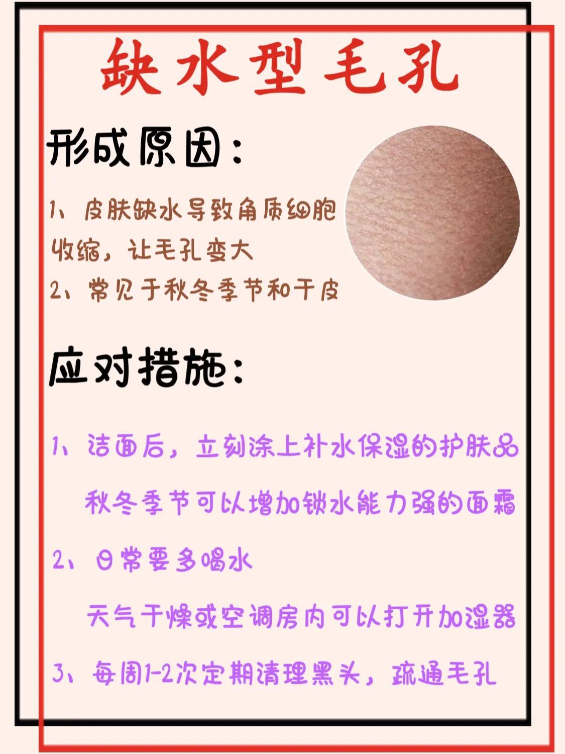 毛孔粗怎么办_教你低成本收缩毛孔