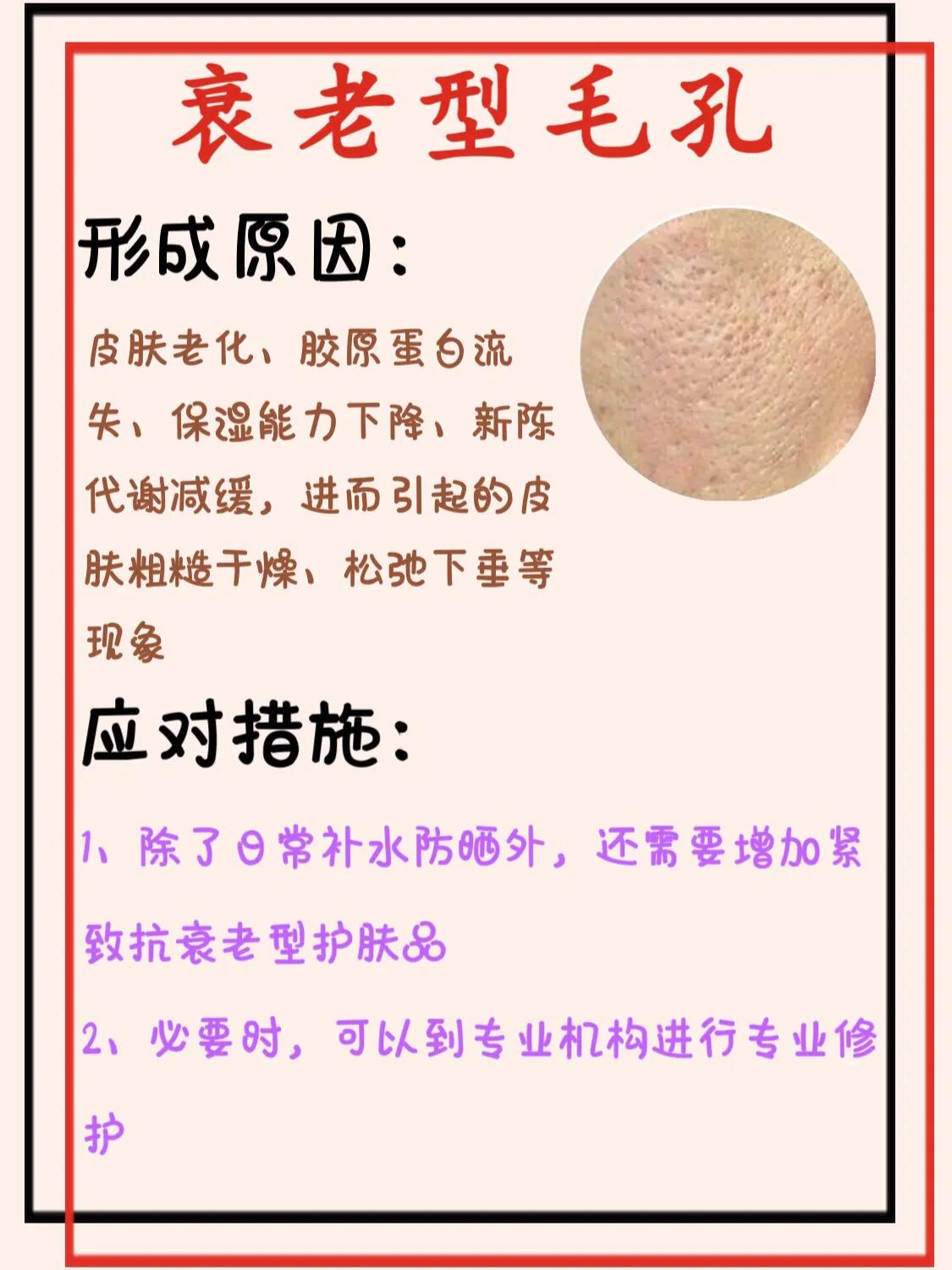毛孔粗怎么办_教你低成本收缩毛孔