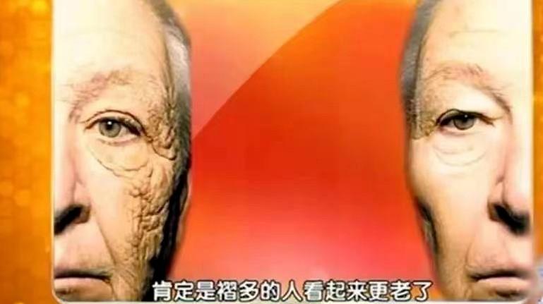 为什么会产生细纹_产生细纹的原因