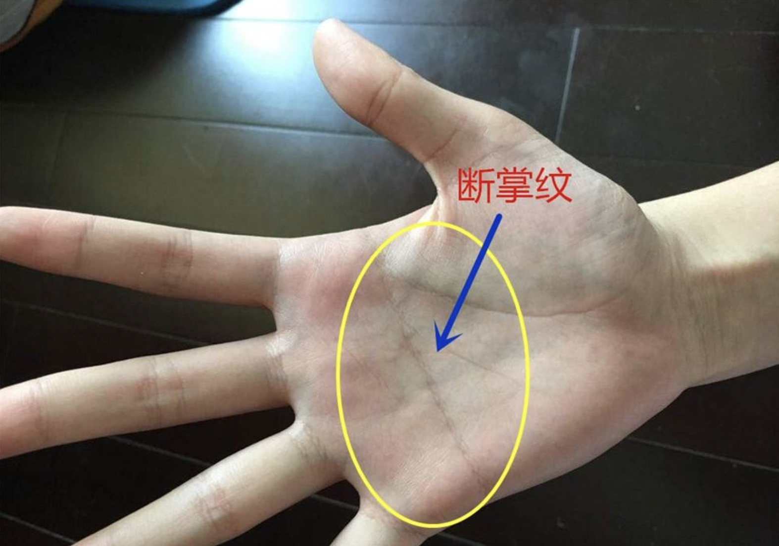 男儿断掌值千金什么意思_断掌男孩的命运怎么样
