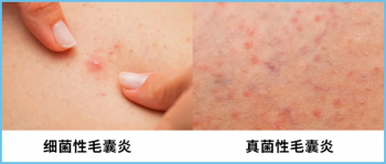 夏季衣服怎么选_夏季衣服选什么面料