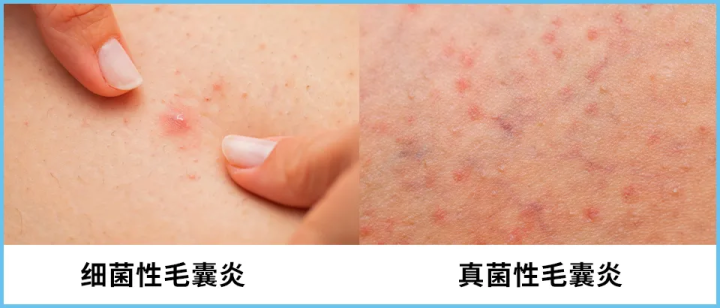 夏季衣服怎么选_夏季衣服选什么面料