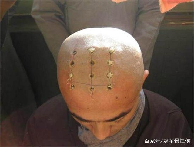 出家和尚为什么头顶有点，和尚脑袋上的点叫什么