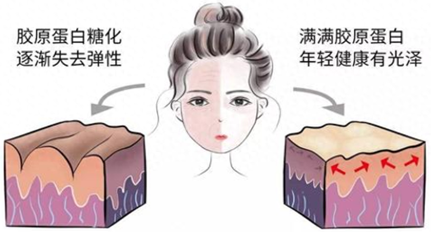 什么是糖化，皮肤糖化怎么修复