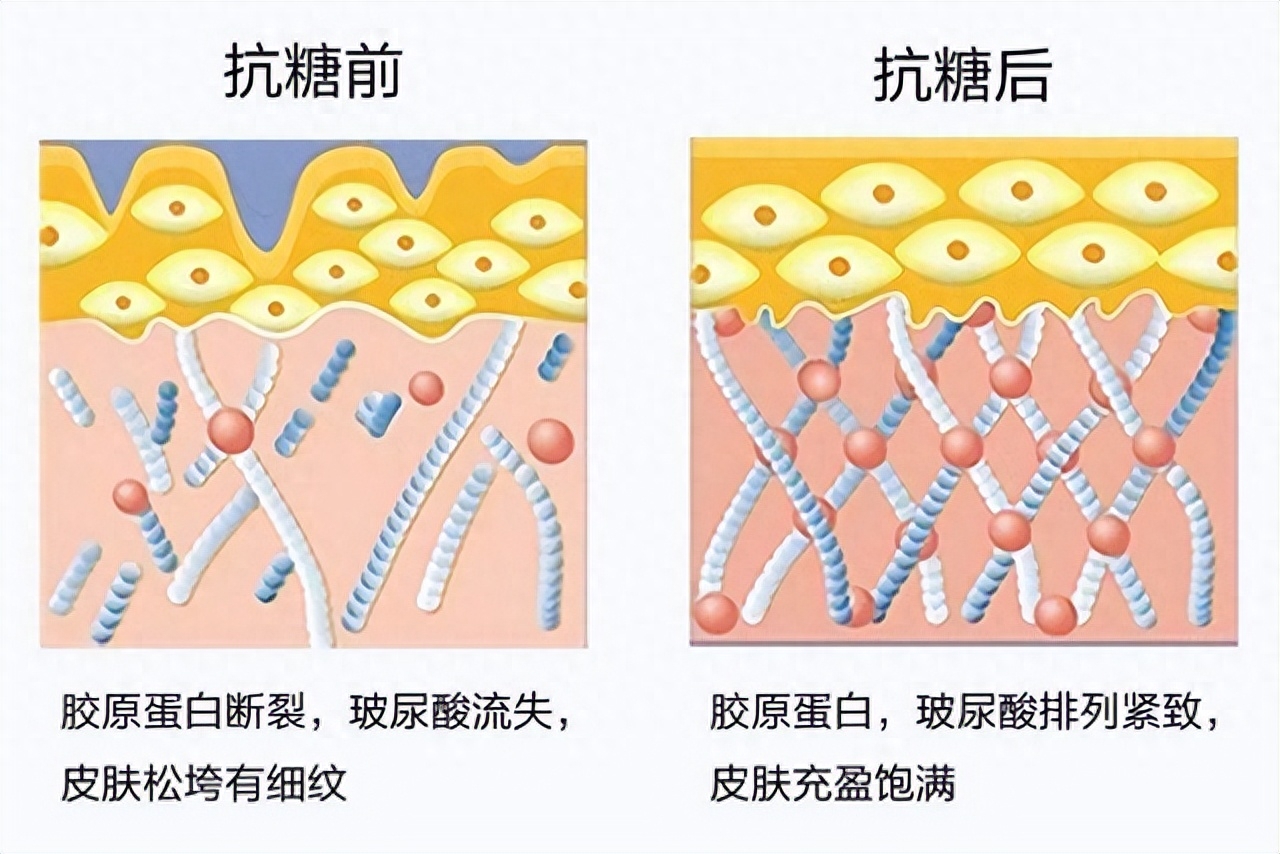 抗糖化有什么作用，抗糖化的功效与作用